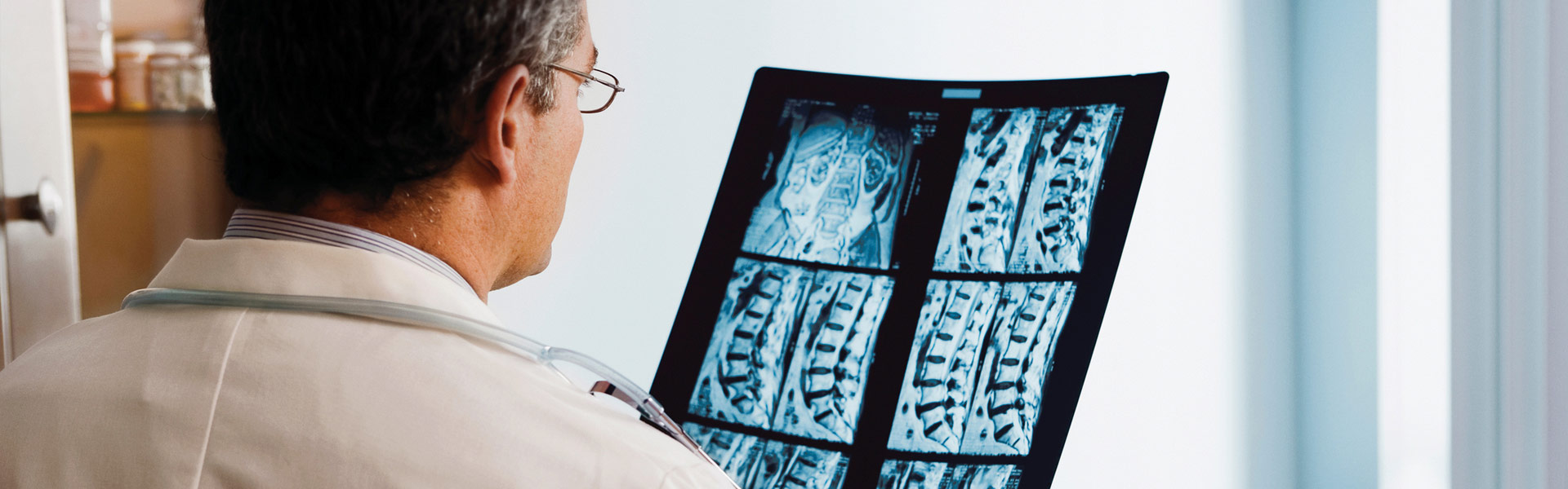 Doctor evaluating an x-ray for a spinal injury
